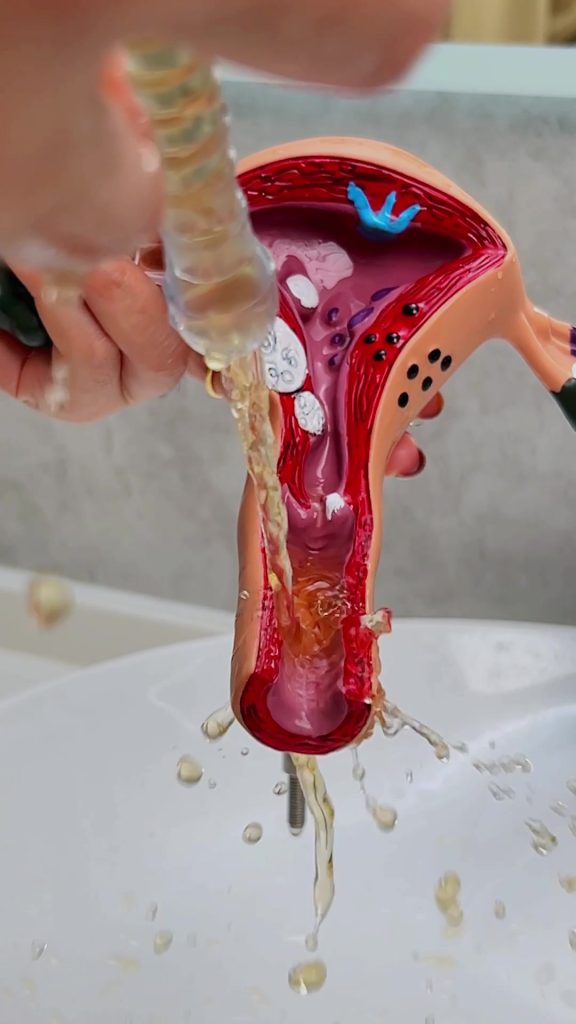 Il s'agit d'une usine en Chine qui produit des produits gynécologiques pour femmes. Accueillir